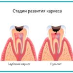 Что такое терапевтическая стоматология